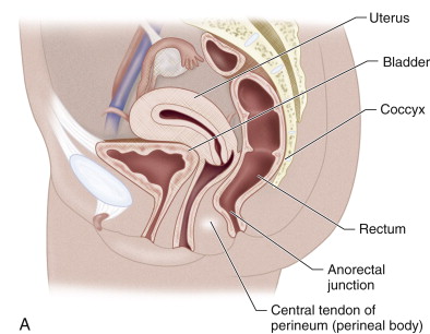 Uterine prolapse. (left) Lateral view of pelvis showing normal