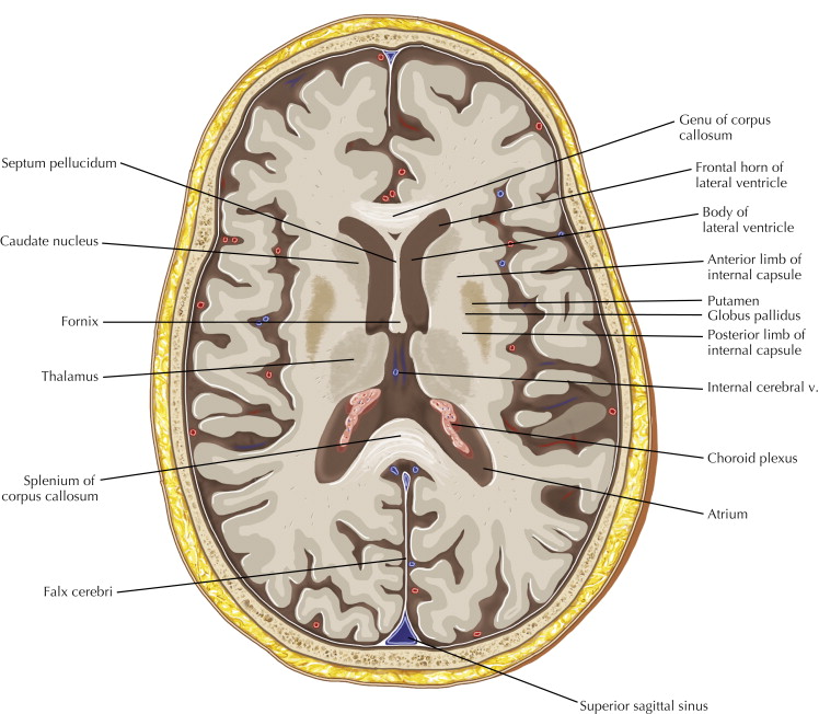 ventricles of the brain mri