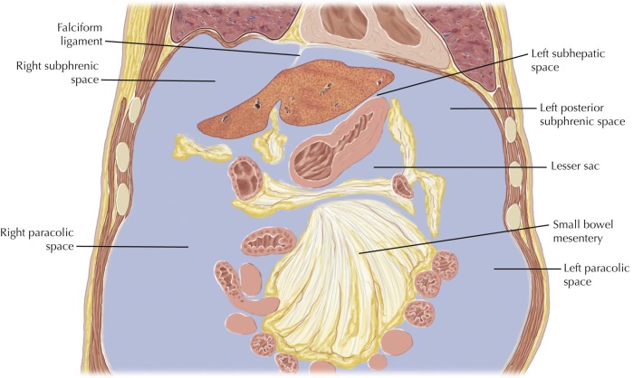 Peritoneal Cavity Radiology Key