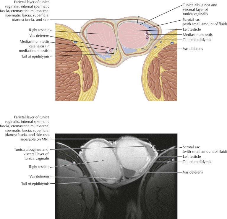 scrotum-and-testes-radiology-key