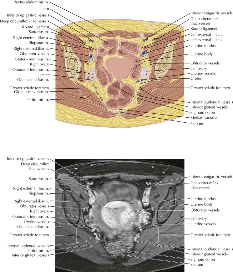 Female Pelvis Anatomy Mri Female Pelvis Anatomy Mri