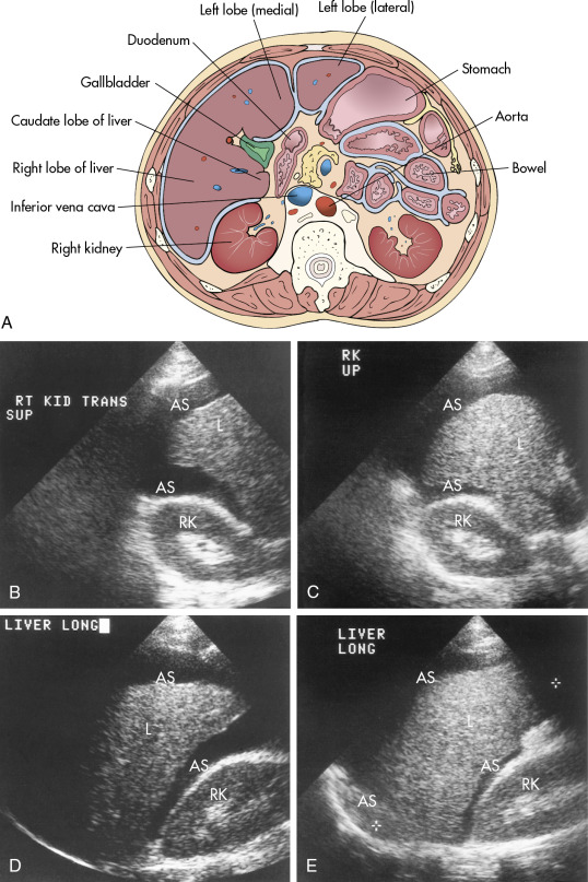 Peritoneal cavity and abdominal wall | Radiology Key