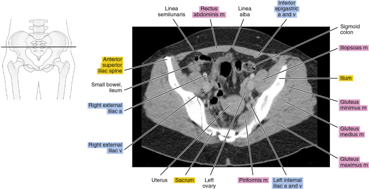 why ct scan abdomen pelvis