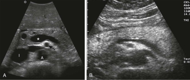 Pancreas: Normal Anatomy and Examination Techniques | Radiology Key