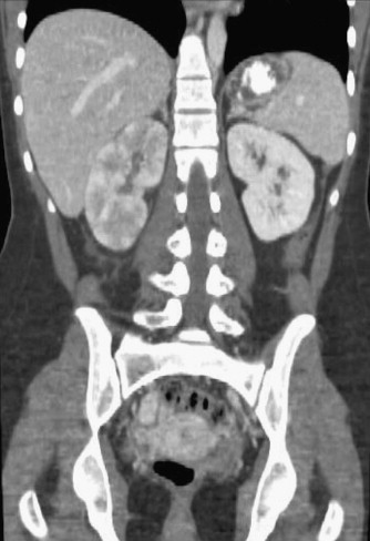 The Acute Abdomen Radiology Key