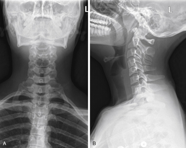 Imaging Soft Tissues of the Neck | Radiology Key