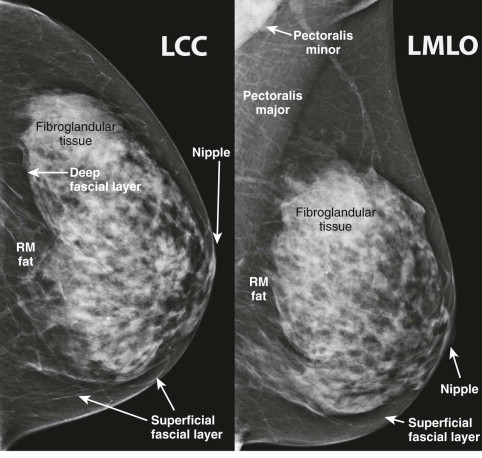 Anatomical diagram of the normal breast showing the distribution of