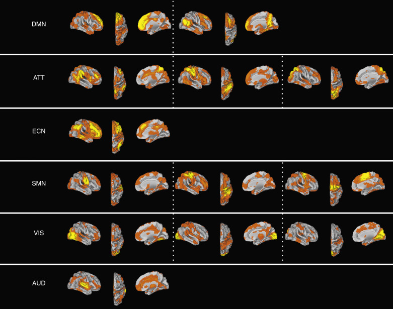 Functional Magnetic Resonance Imaging Radiology Key