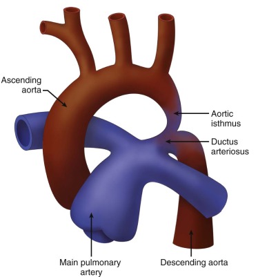 transverse arch aorta