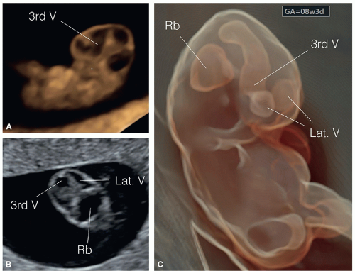 The Fetal Central Nervous System Radiology Key 