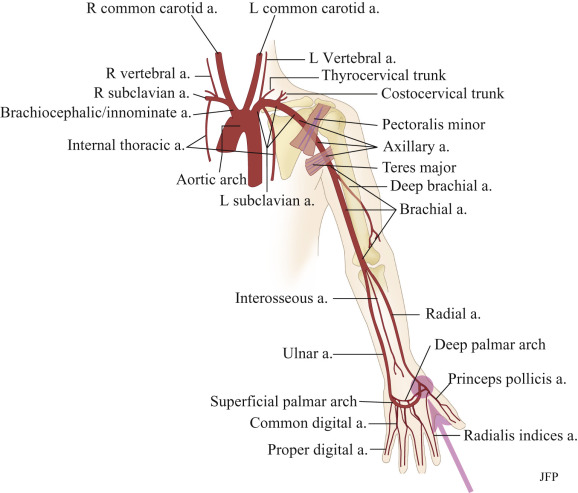 assessment-of-upper-extremity-arterial-disease-radiology-key