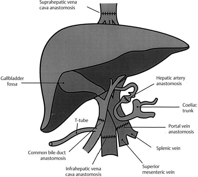 Anatomy Of Hepatobiliary System