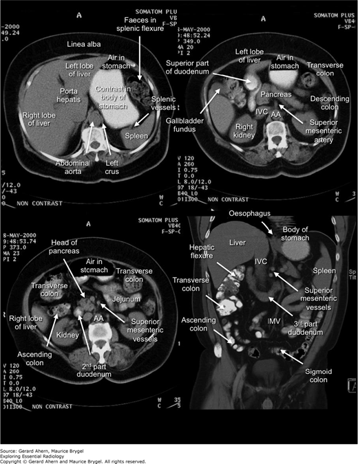 Abdomen Radiology Key