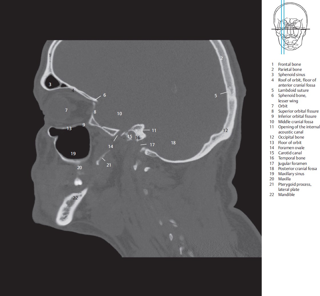 Sagittal Sections Radiology Key