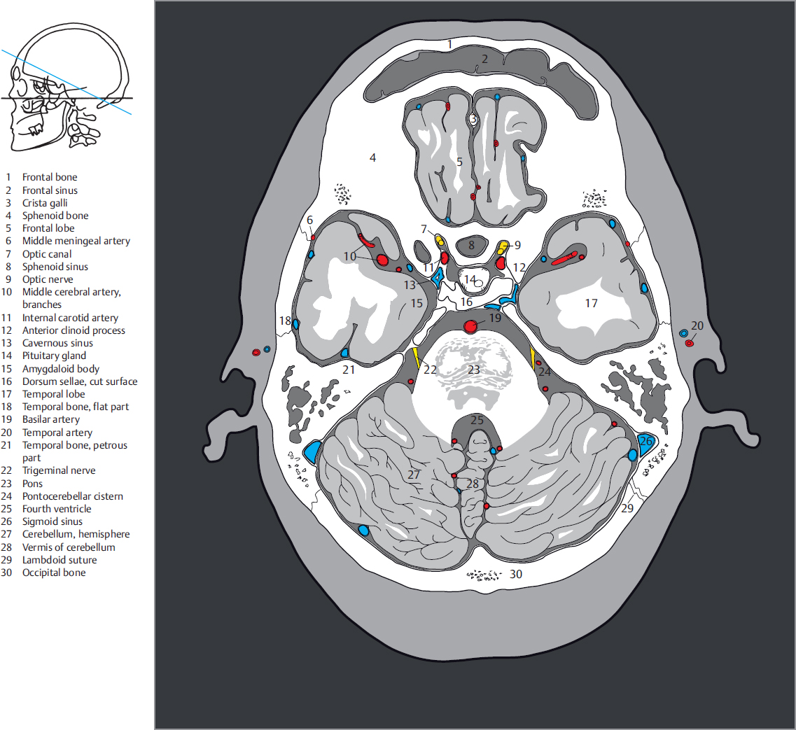 5-transverse-sections-radiology-key