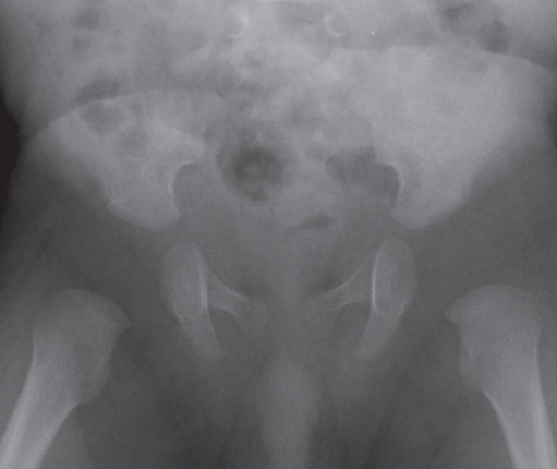 The pelvis  Radiology Key