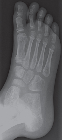 Male Foot  Radiology Key