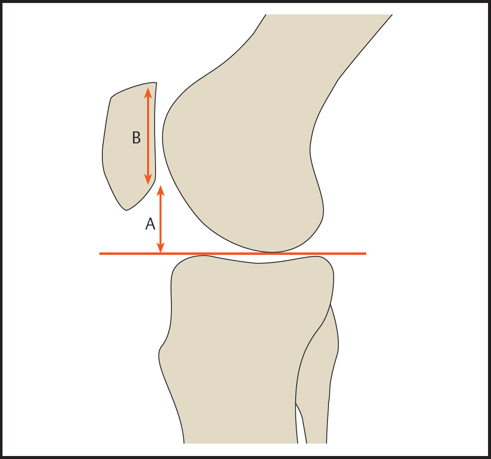 Knee | Radiology Key