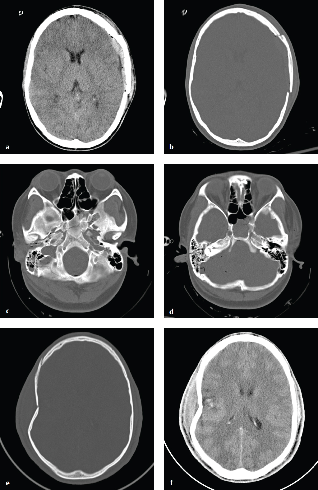 2 Brain Radiology Key 9390