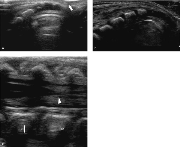 Spine Radiology Key