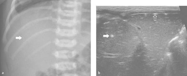 9 Liver And Biliary System Radiology Key