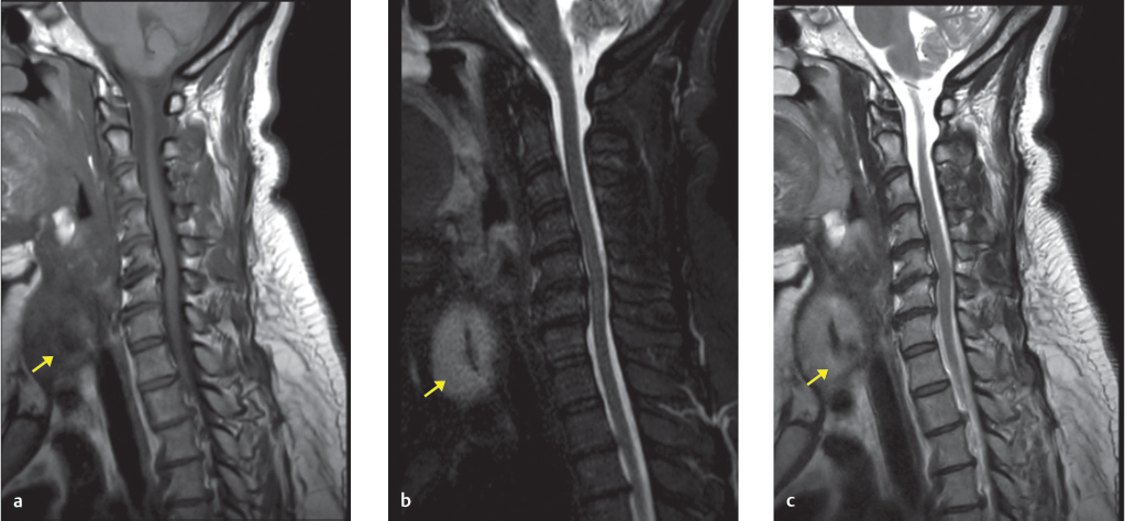 37-thyroid-mass-radiology-key