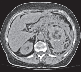 27 Kidneys  Radiology Key