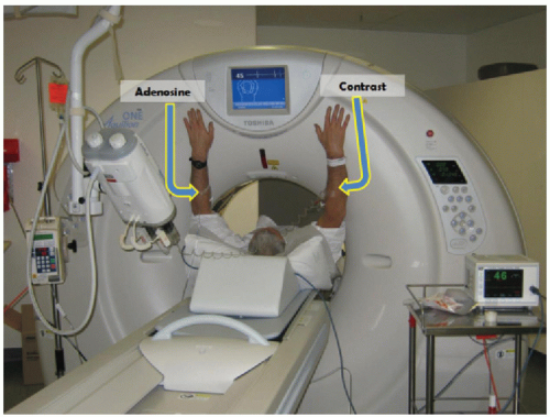 myocardial-perfusion-imaging-ct-applications-radiology-key