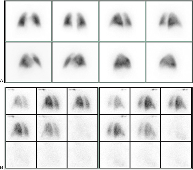 Pulmonary System | Radiology