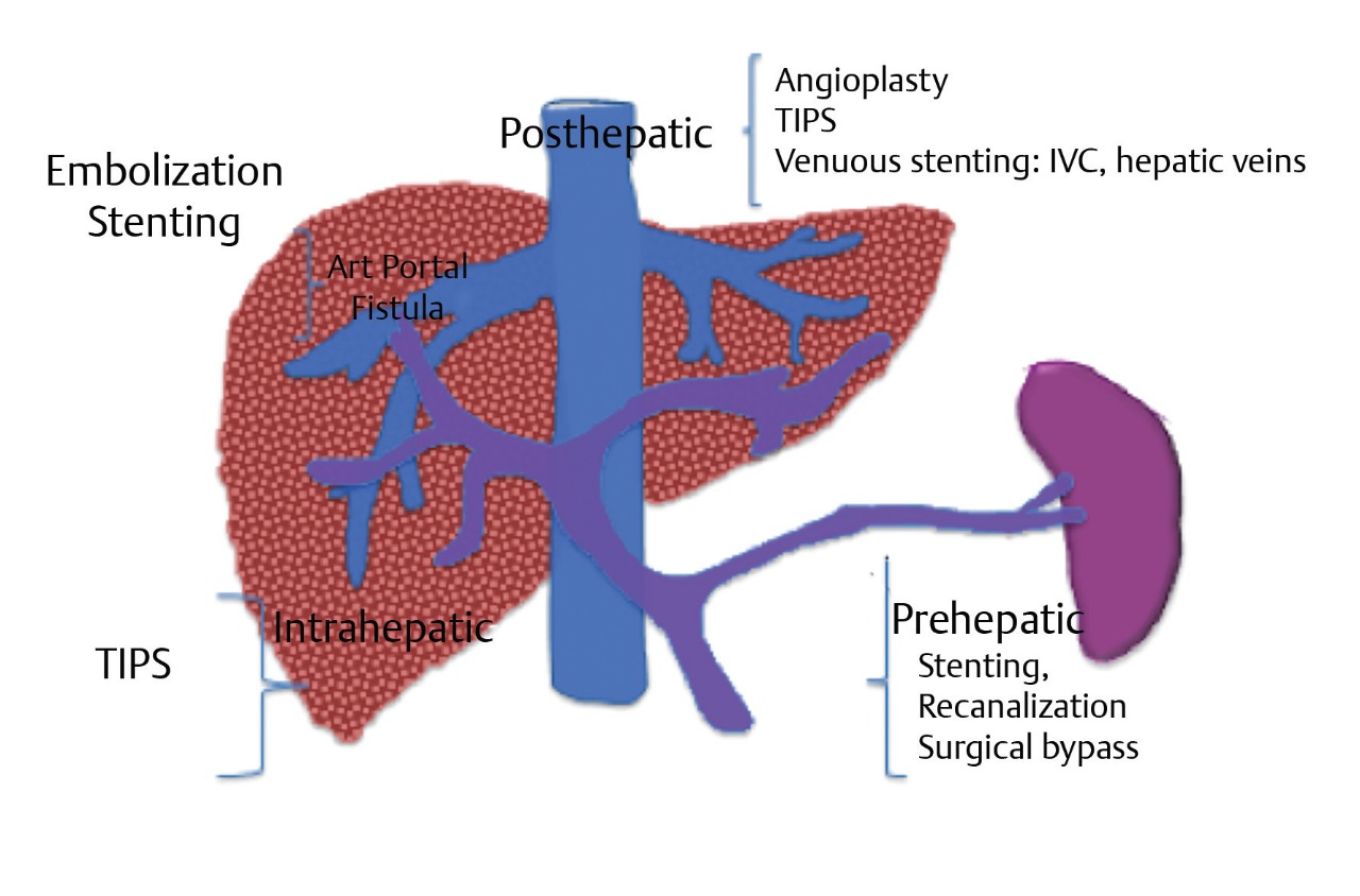 hepatic vein vs portal vein