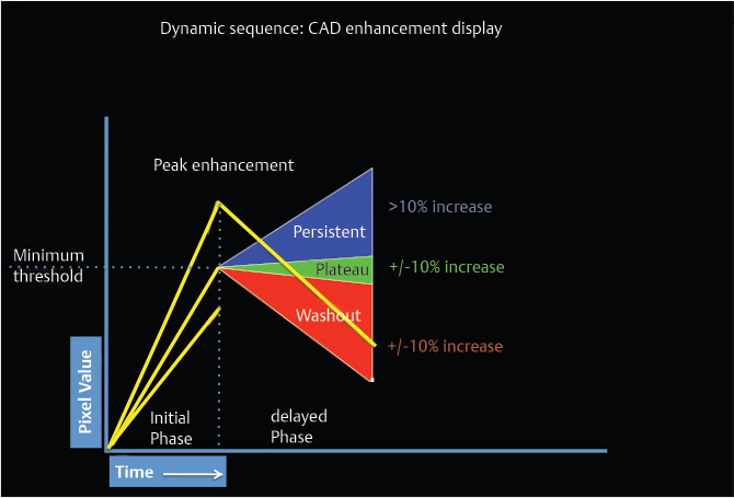 Time-signal intensity curve for breast lesions. A type I curve shows