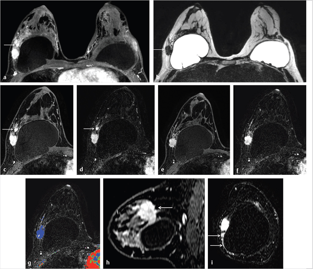 6 Diagnostic MRI Interpretation