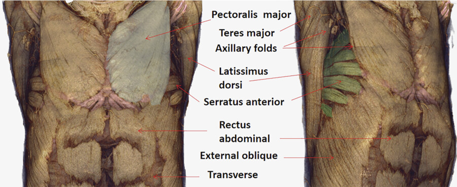 Thorax 1: Anatomy of the Thoracic Wall