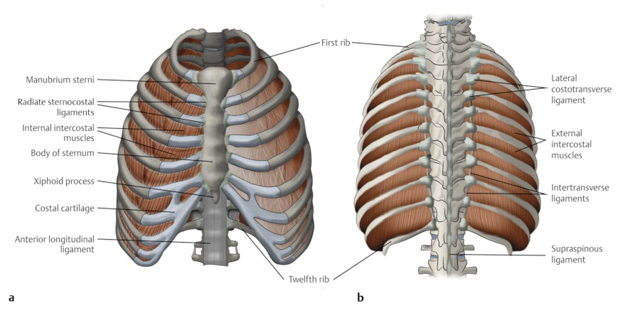 Bell-shaped chest resulting from insufficient intercostal muscle