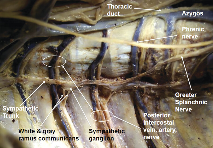 thoracic duct cadaver