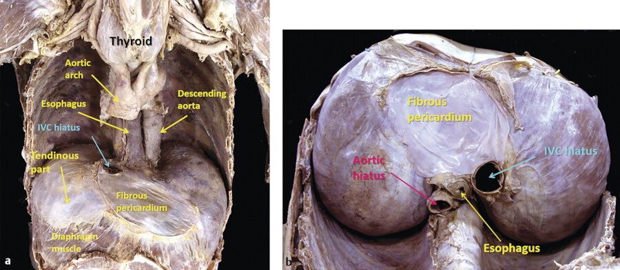Major openings of the diaphragm: lateral view
