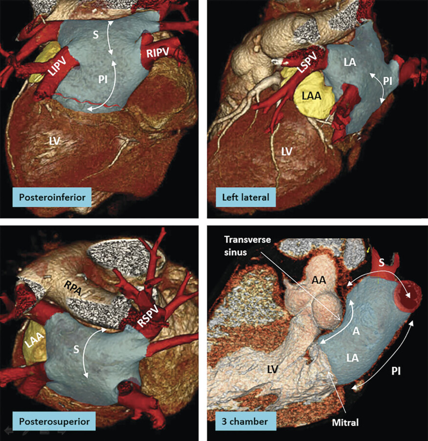 12 General Anatomy of the Heart | Radiology Key