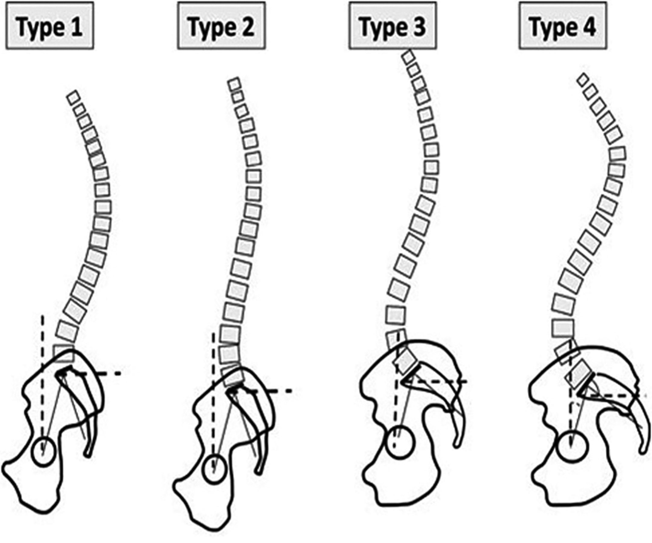 Full Length Spine—clinical Correlations With Specific Phenotypes And