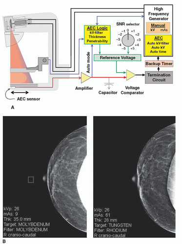 MAMMOGRAPHY  Radiology Key