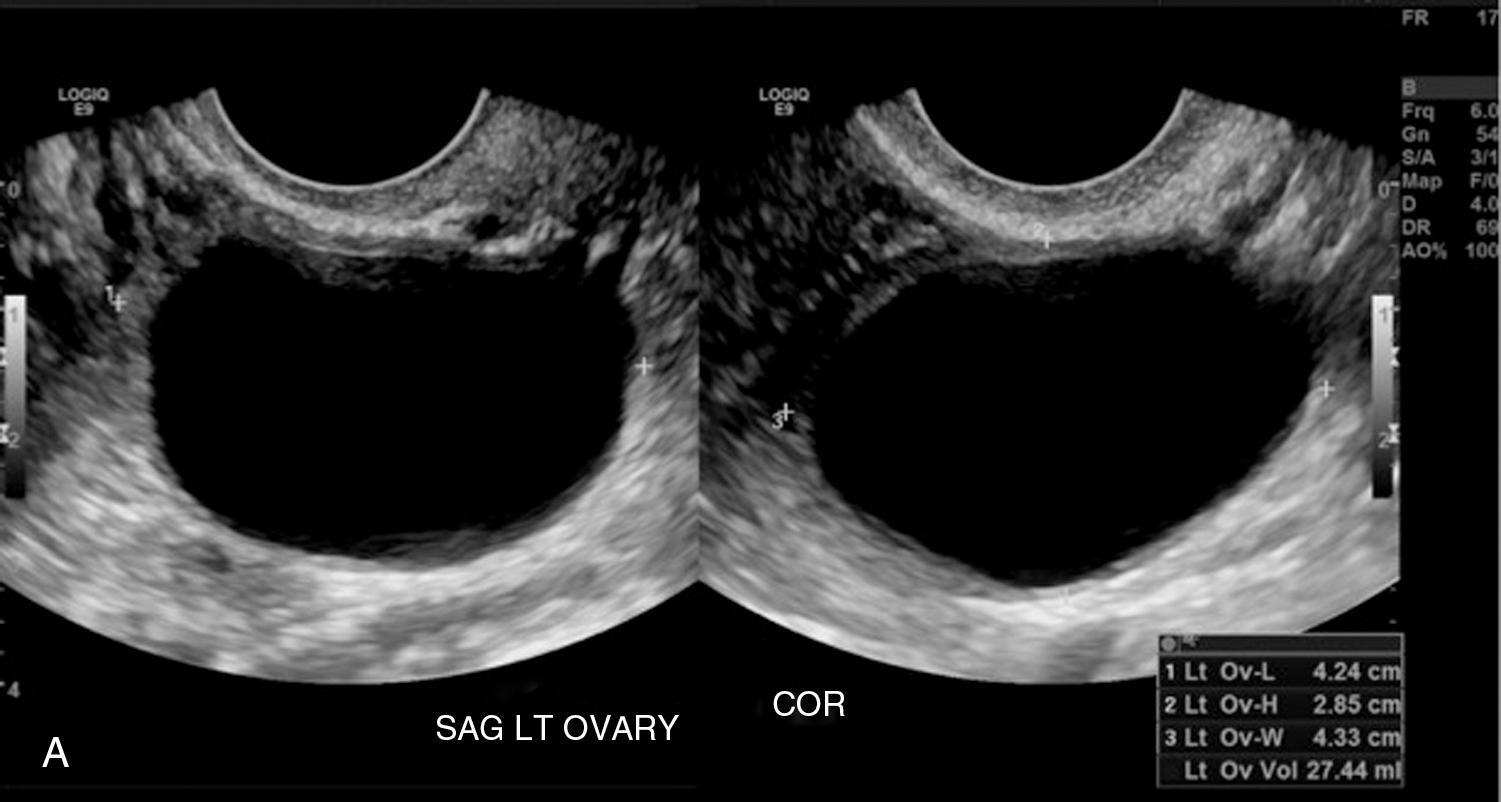 uterus-and-adnexa-uterus-part-and-section-view-and-khow-all-part-so