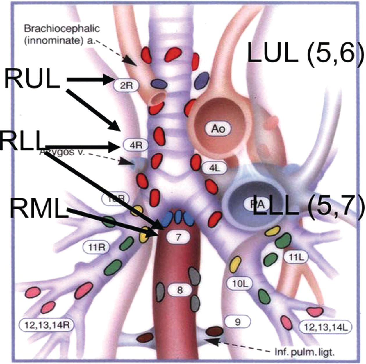 Mediastinal Lymph Nodes