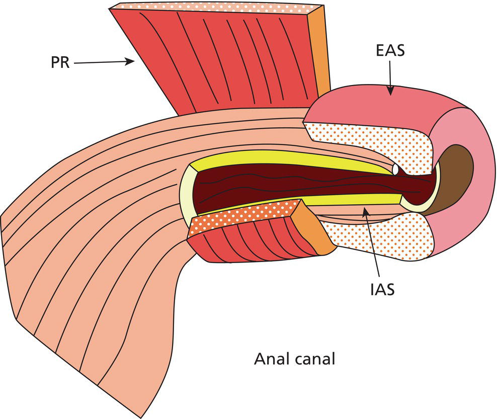 Anal Sphincter Disease Radiology Key