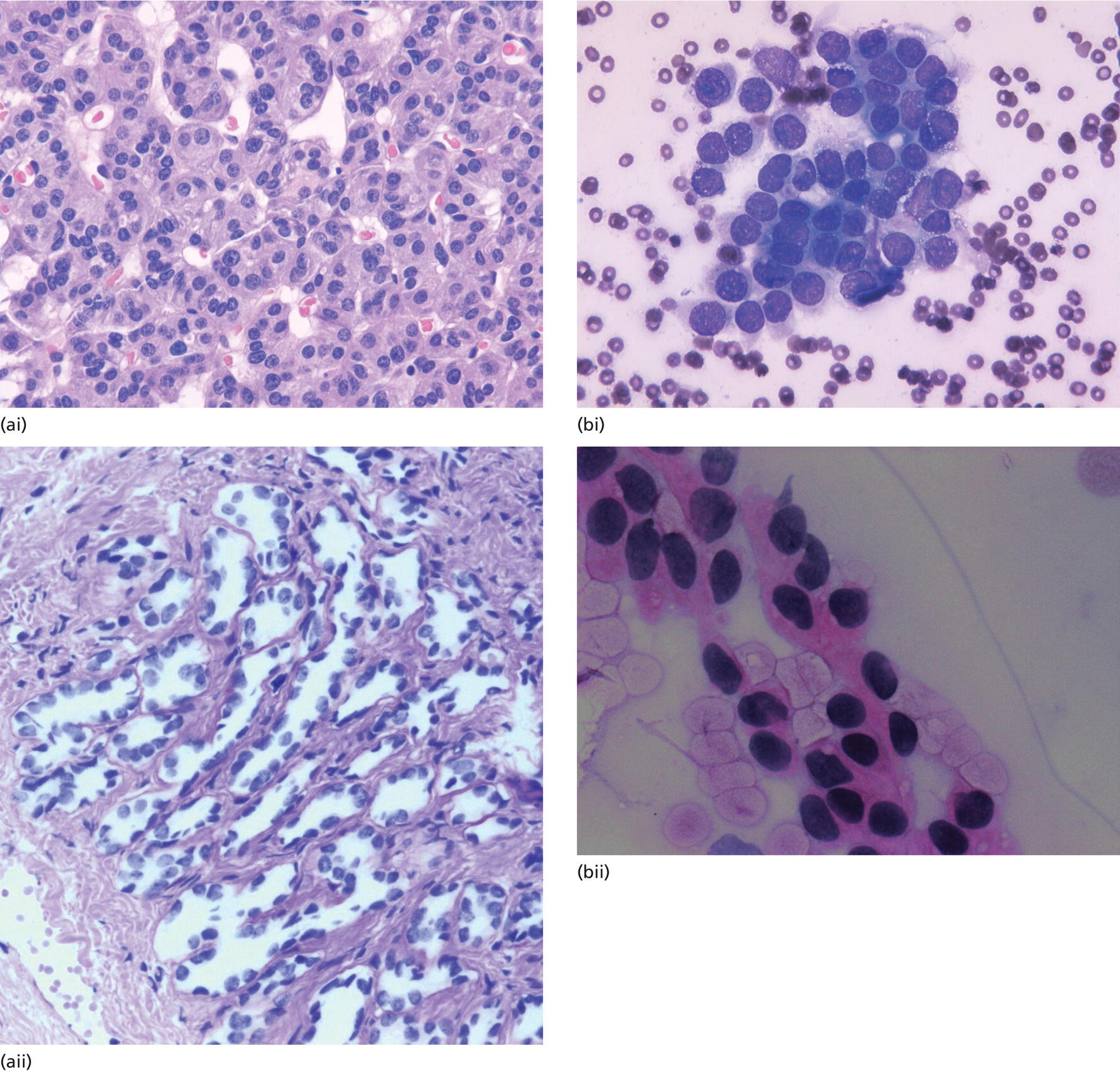 How To Interpret Eus‐fna Cytology Radiology Key