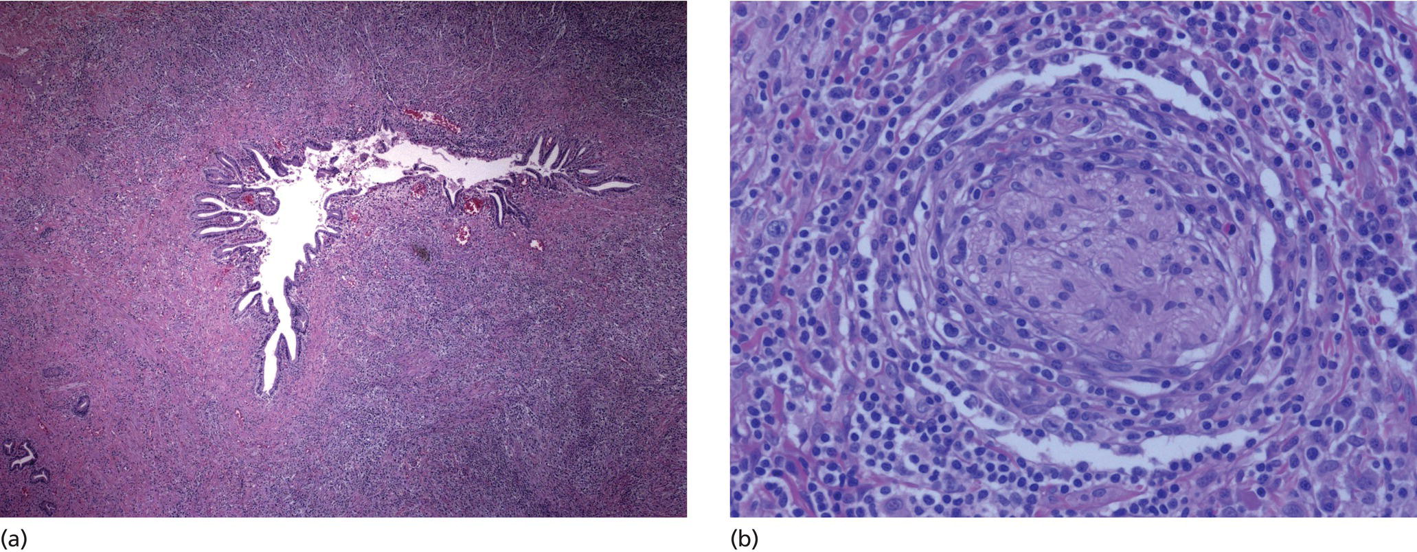 How To Interpret Eus‐fna Cytology Radiology Key