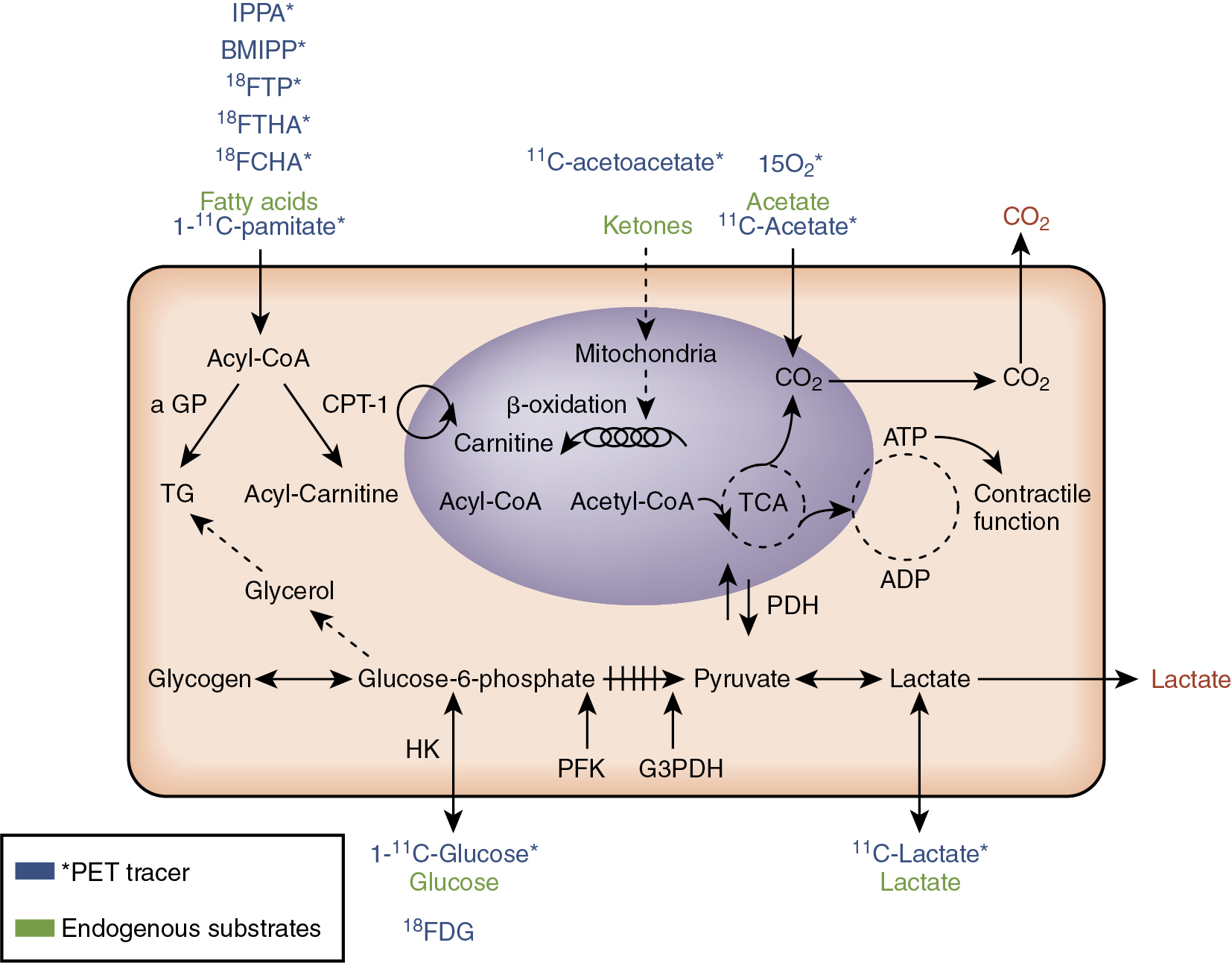 metabolic-remodeling-in-heart-failure-radiology-key