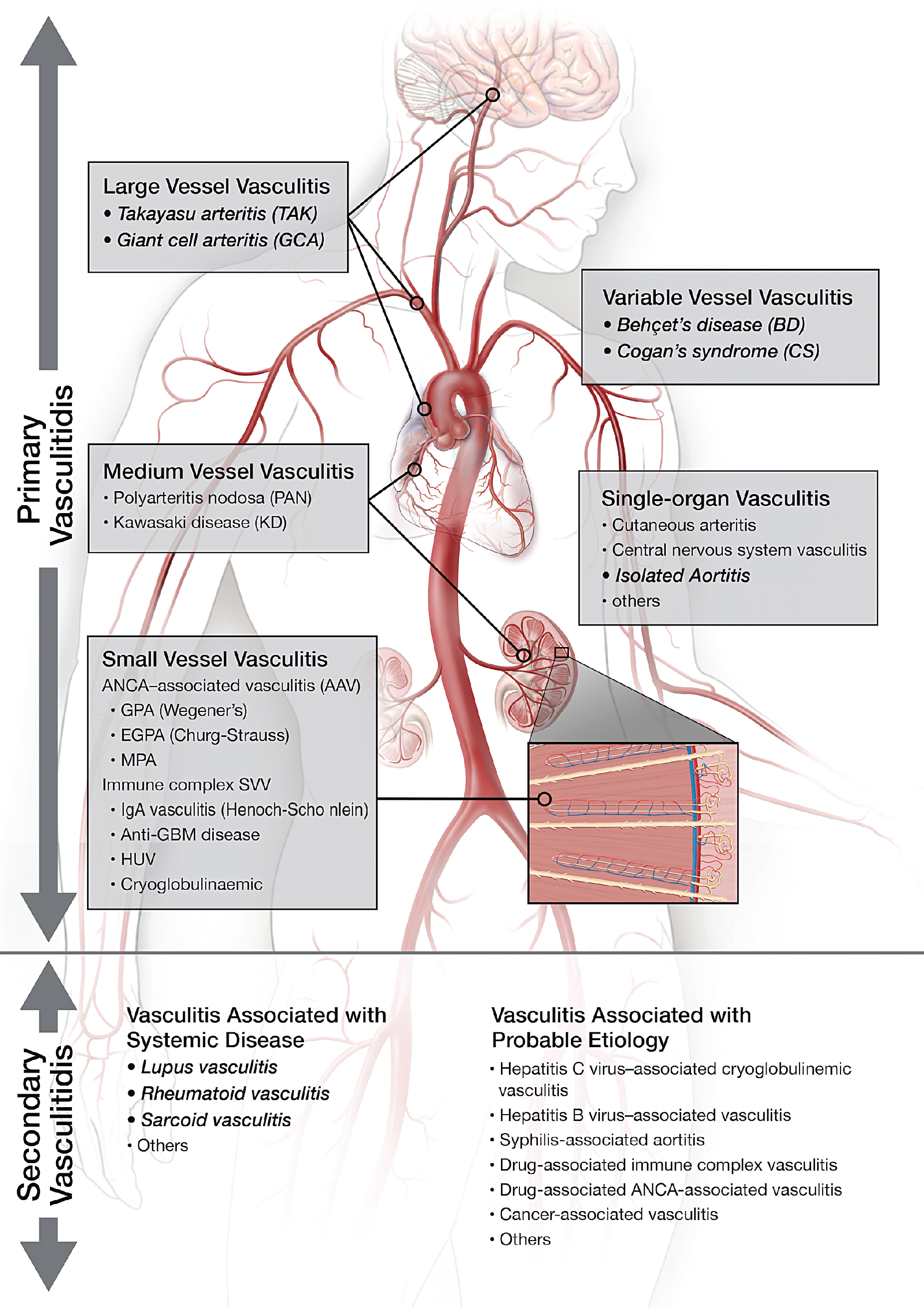 large-vessel-vasculitis-radiology-key