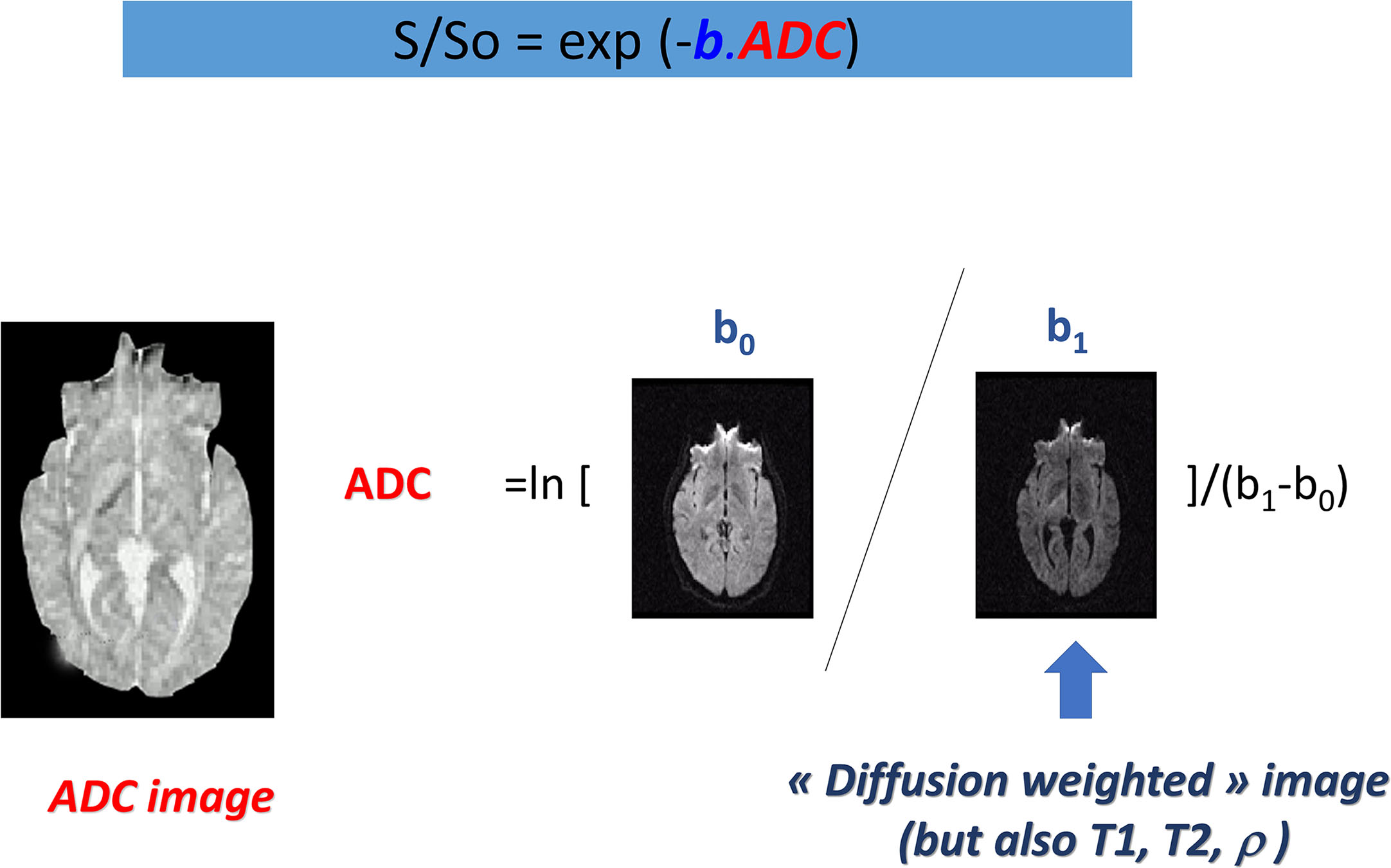 General Principles And Challenges Of Diffusion MRI | Radiology Key