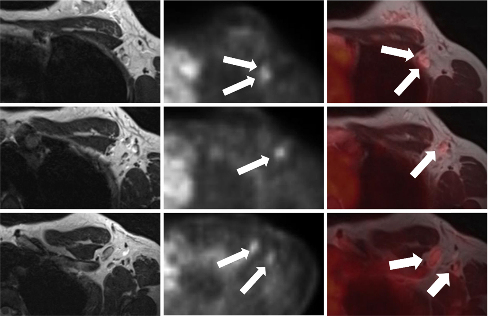 Breast Imaging Radiology Key 8117