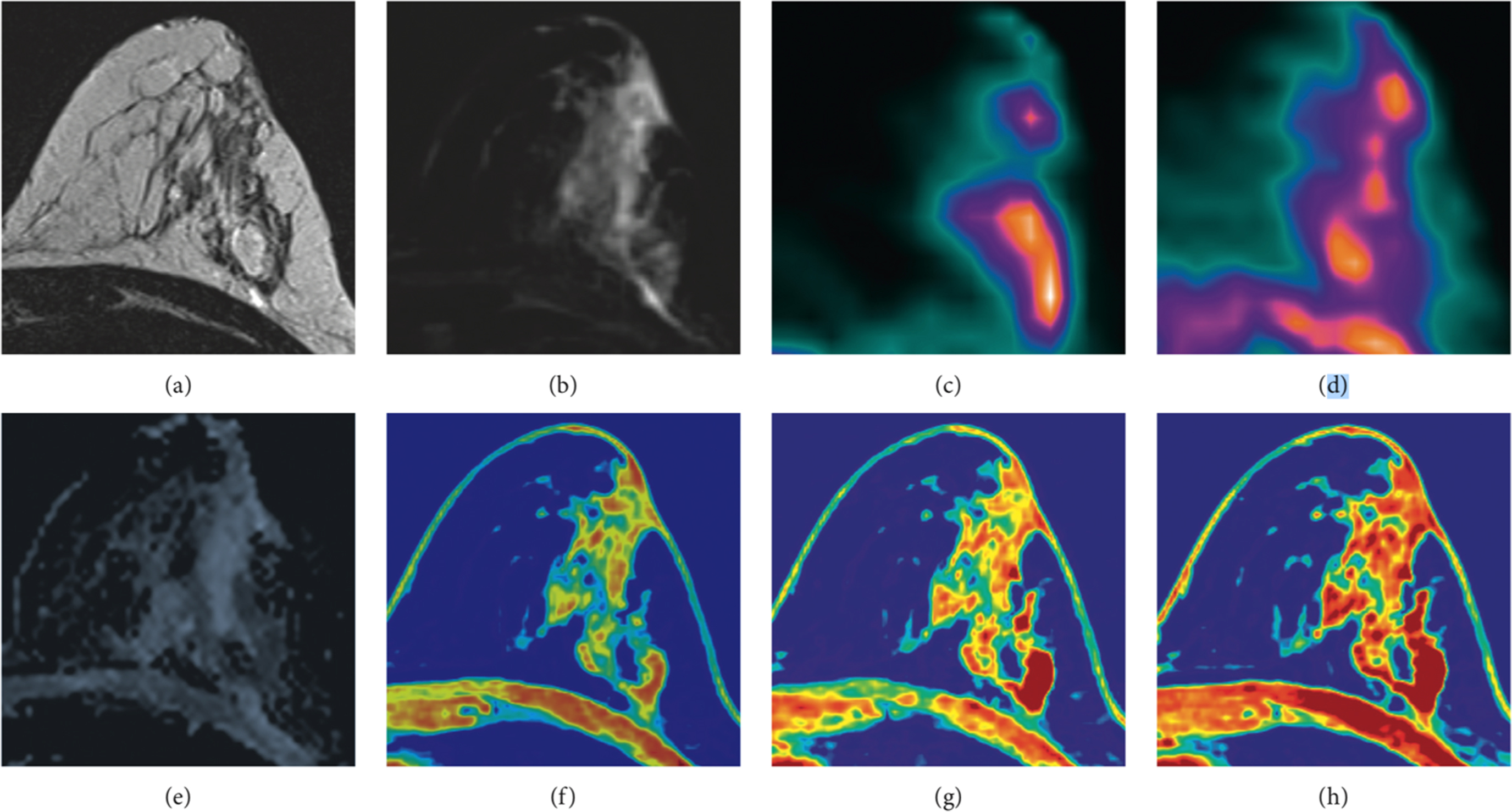 Breast Imaging Radiology Key 7484