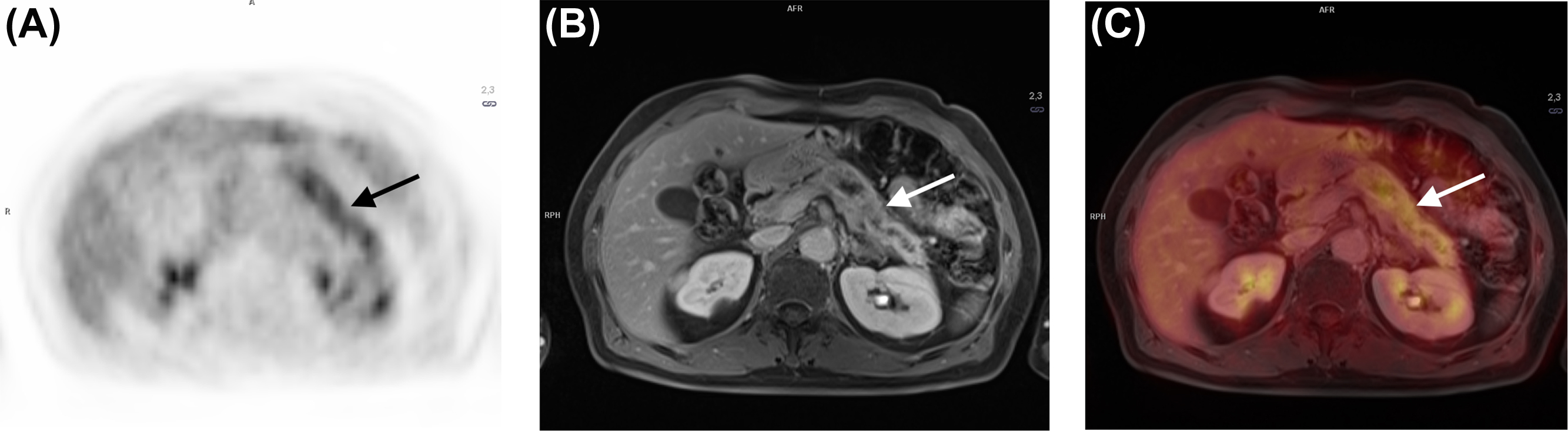 Hepatobiliary And Pancreatic Imaging Radiology Key